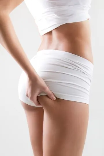 Gluteoplastia com prótese